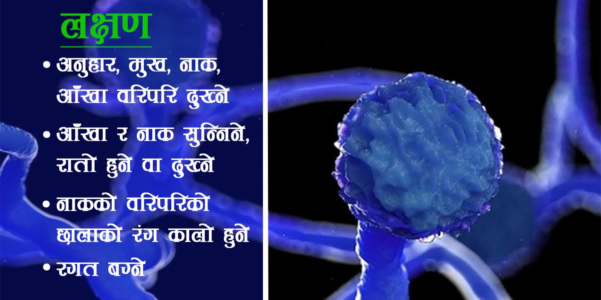 'Black Fungus ' found in 10 people in Nepal, How to safe ?